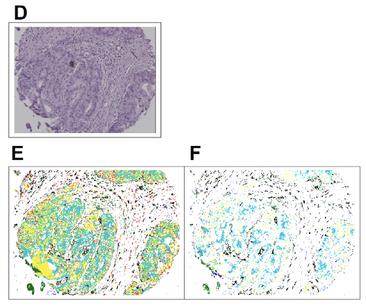 Studying therapy effects and disease outcomes in silico using artificial counterfactual tissue samples